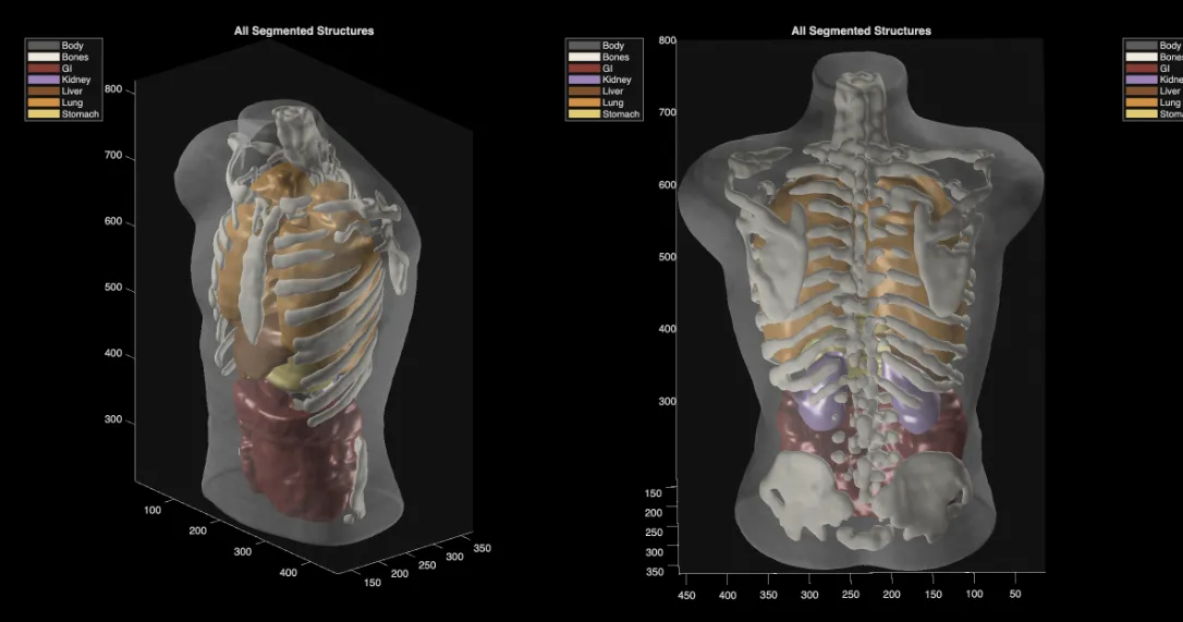A behind-the-scenes look at Midjourney’s medical scanner leaves many questions unanswered