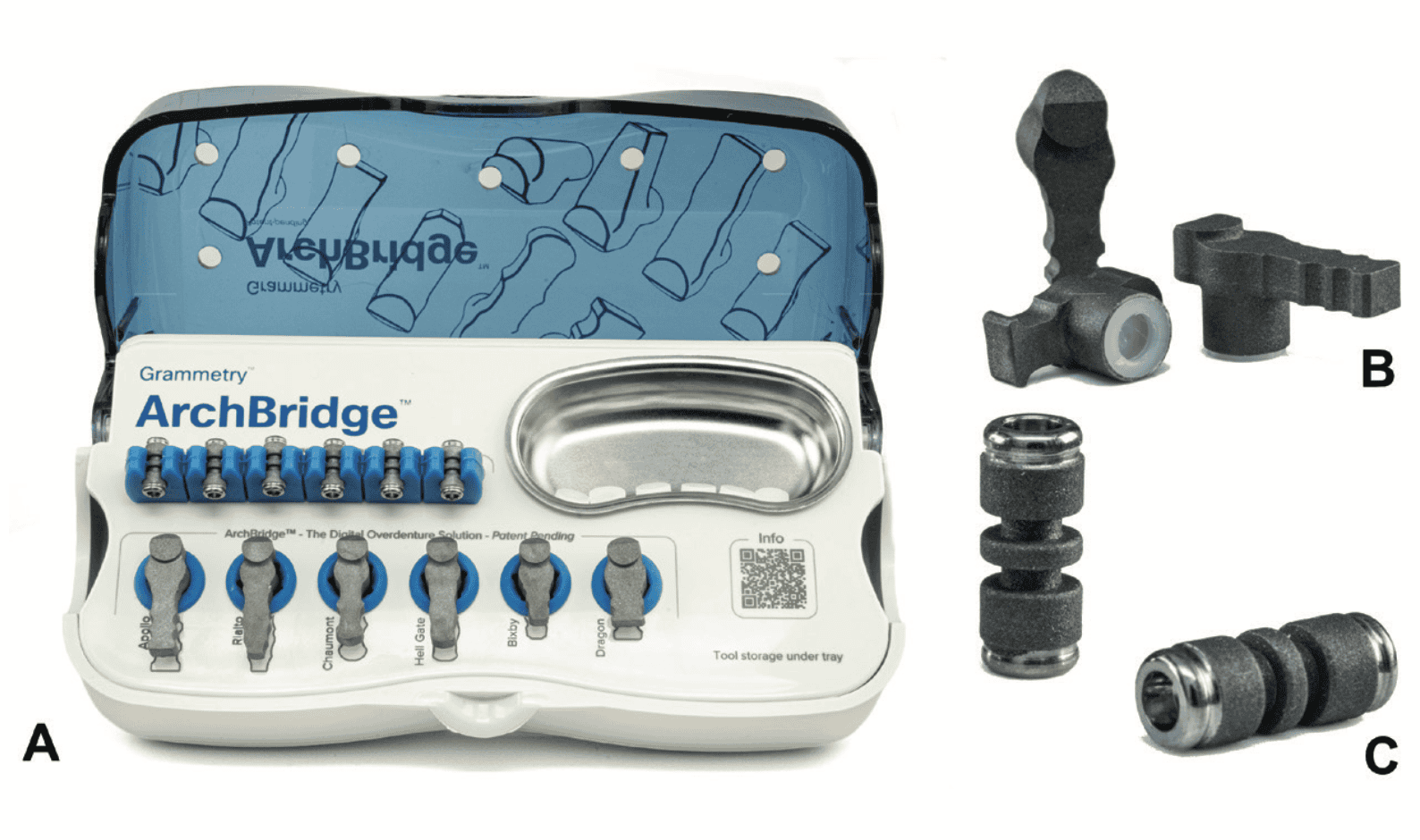Simplifying Implant-Supported Overdenture Prosthetics: A Digital Workflow